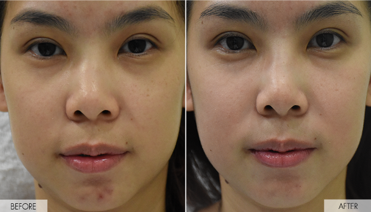 Sensitive Skin and Seborrheic Dermatitis Bangkok Aesthetic Clinic