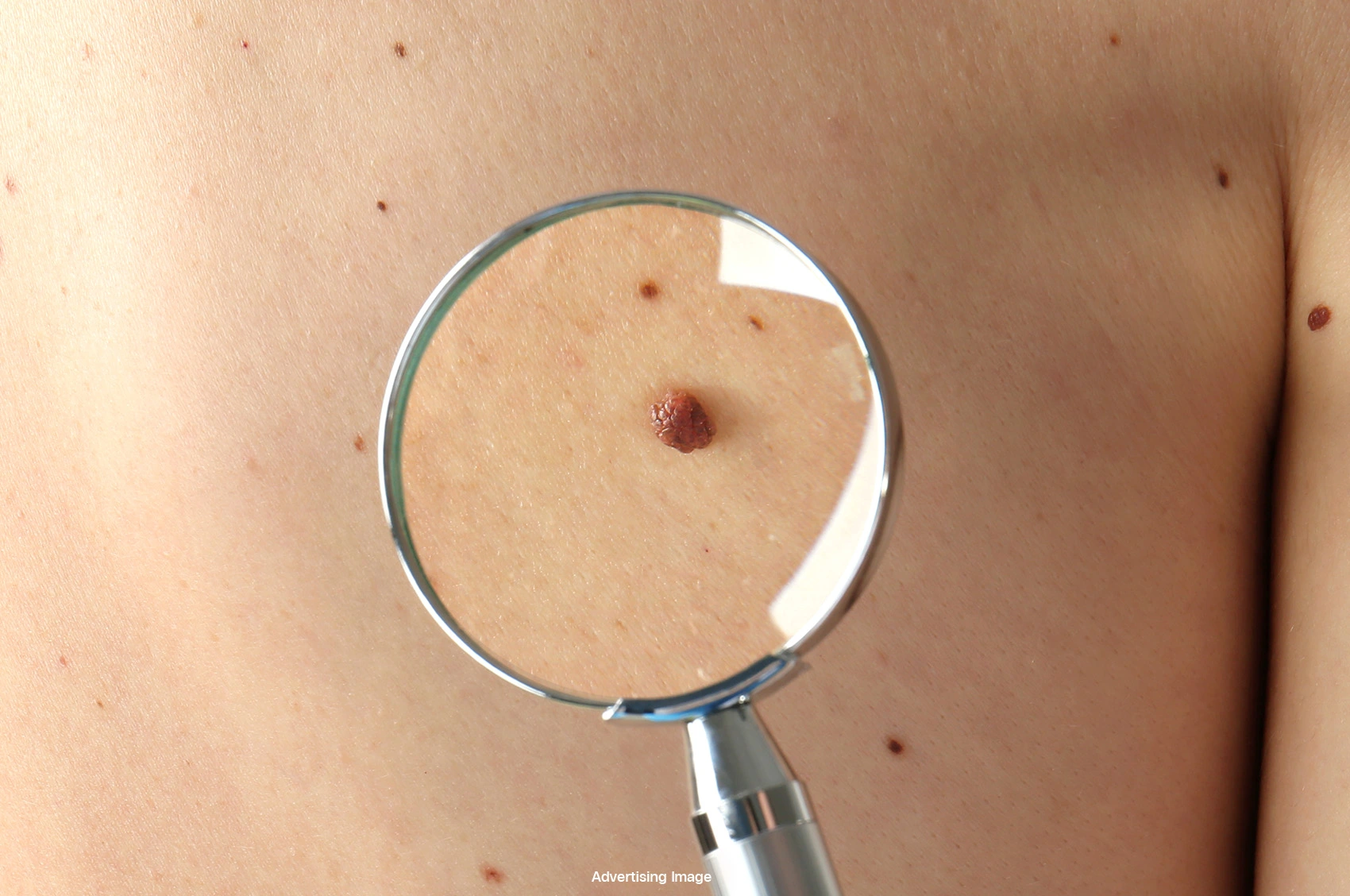 Moles