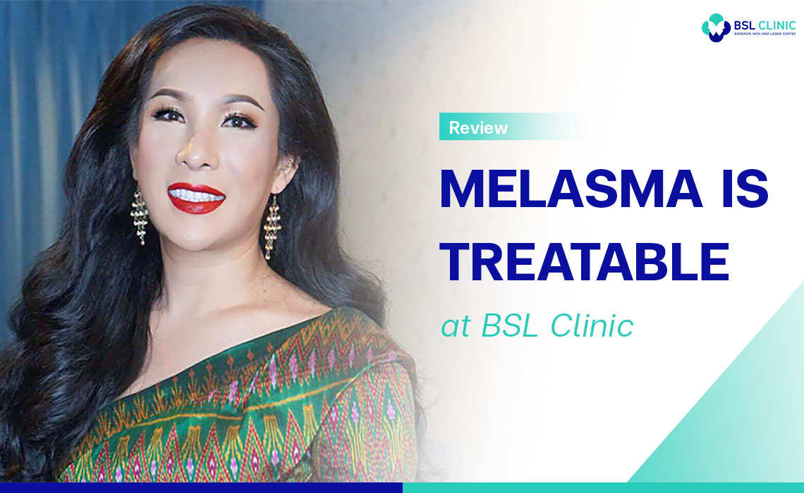 Melasma-is-Treatable-at-BSL-Clinic