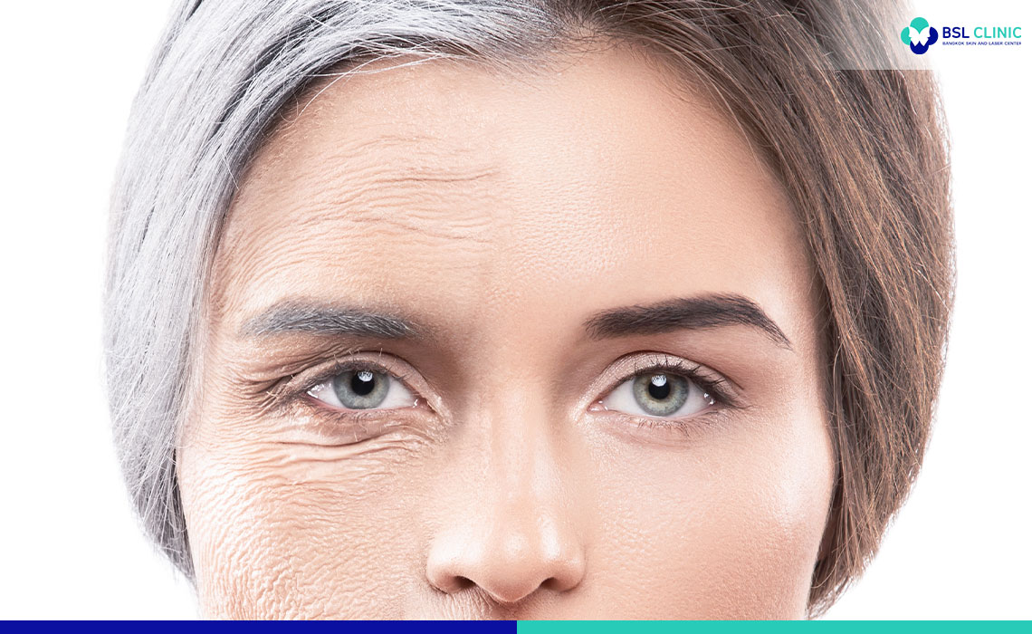 When-should-wrinkles-first-be-treated-