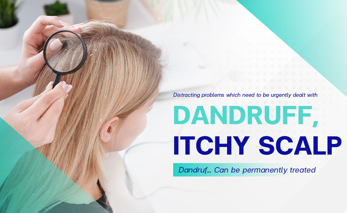 Dandruff-Itchy-Scalp