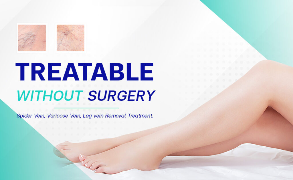Spider and Varicose Veins Bangkok Aesthetic Clinic