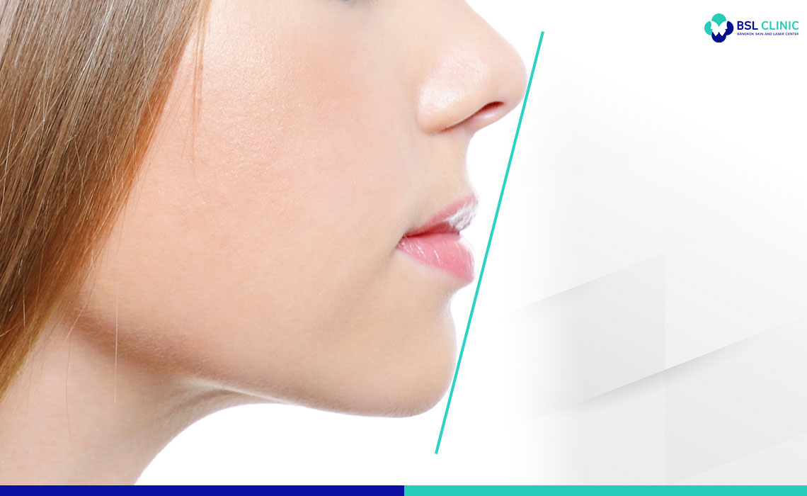 Side-View--Features-of-Ideal-Lips02