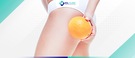 Anti-Cellulite - Bangkok Aesthetic Clinic