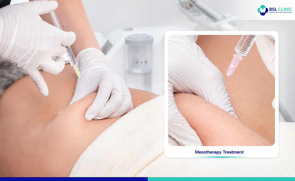 Mesotherapy-Treatment-Fat-Removal