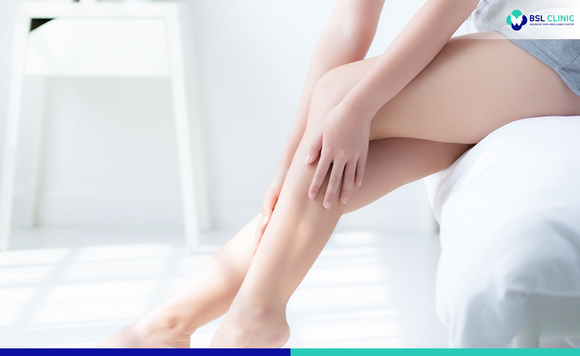 What-to-expect--Sclerotherapy