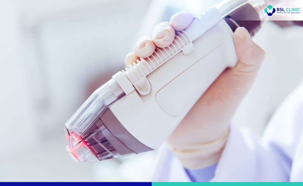 Scar Removal Laser Bangkok Aesthetic Clinic