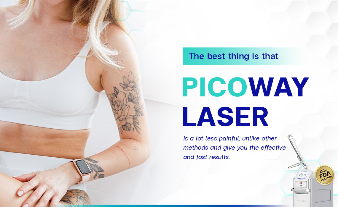 PicoWay Laser (Tattoo Removal)