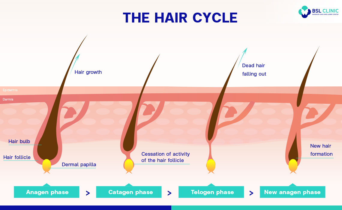 hair-cycle-Hair-Removal-Laser