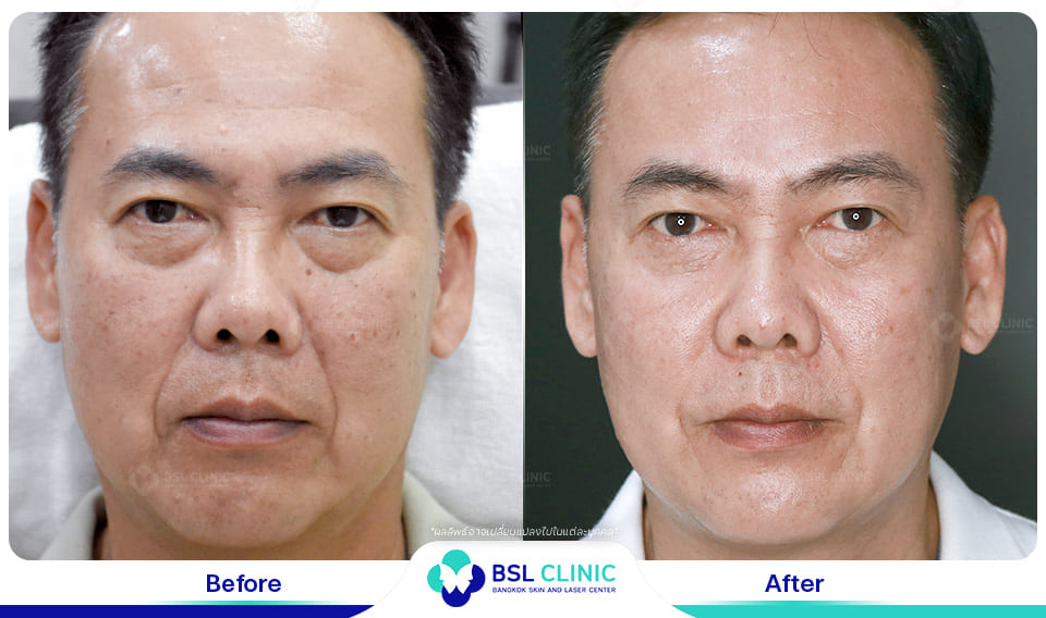 Facial Design and Anti-Aging Treatments