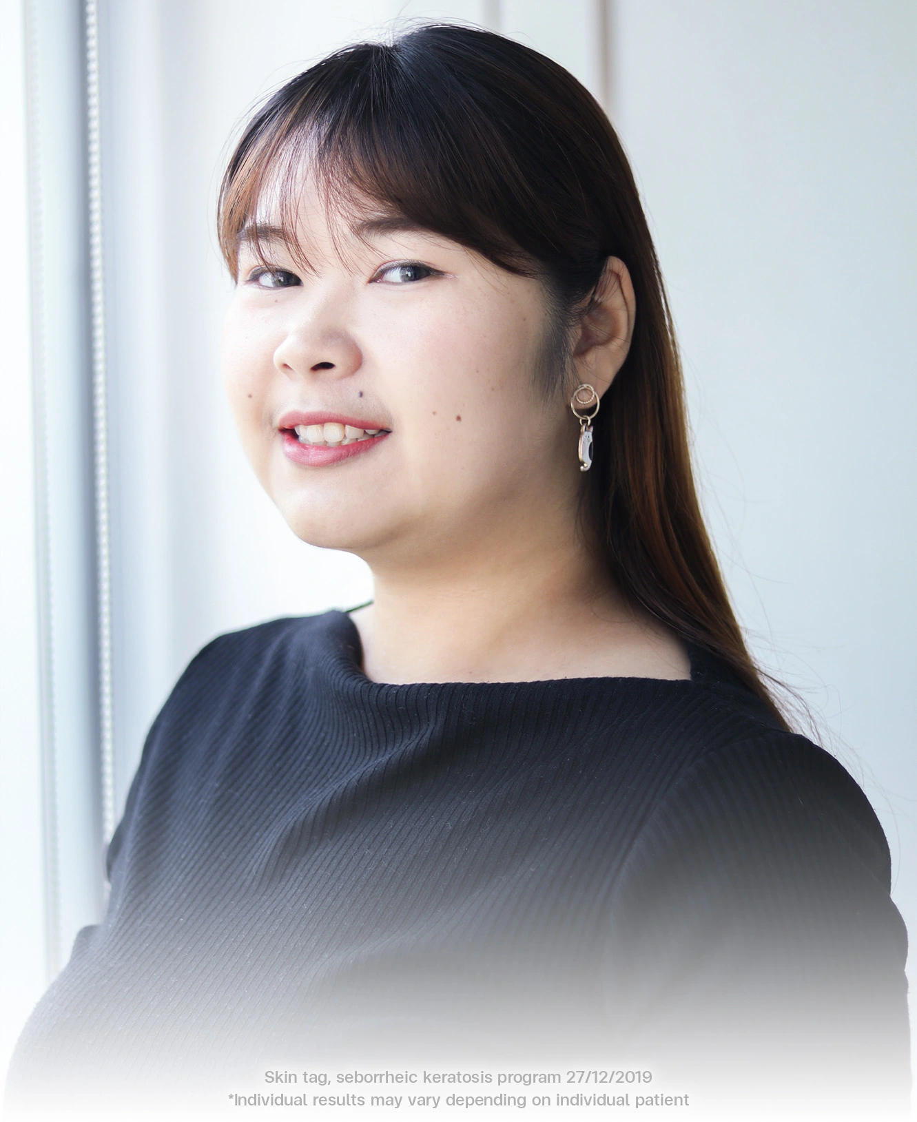 real-results-seborrheic-keratosis-and-skin-tag-removal-at-bsl-clinic-bangkok-thailand-using-co2-laser-safe-treatment-for-neck-bumps-milia-syringoma-and-skin-tag-removal-co2-laser-bangkok-price-skin-tag-removal-thailand-bangkok-mole-removal-results