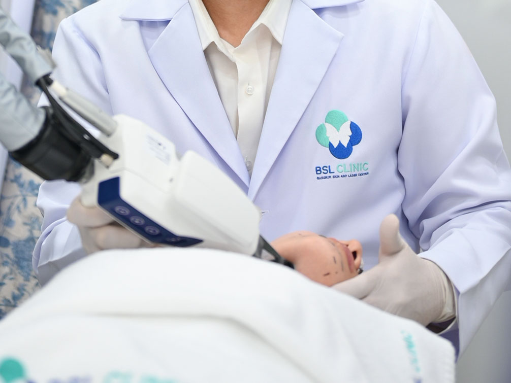 accure laser at bsl clinic