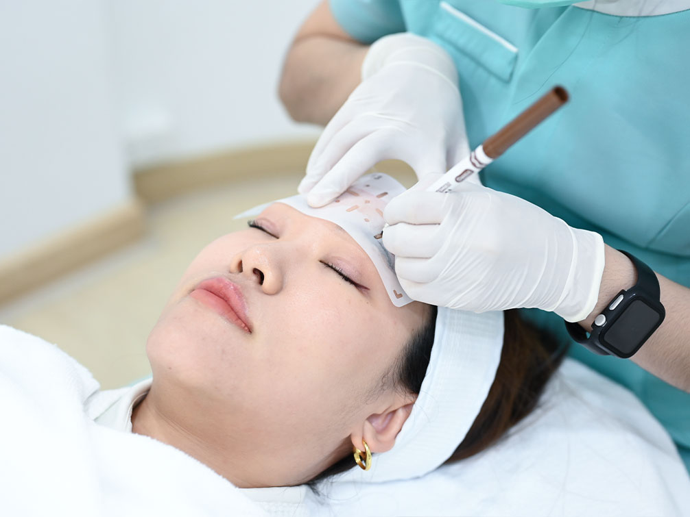 accure laser at bsl clinic