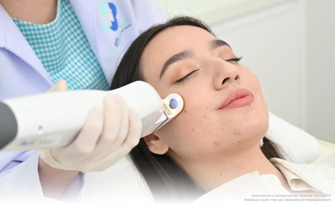 AviClear-Laser-Program-at-BSL