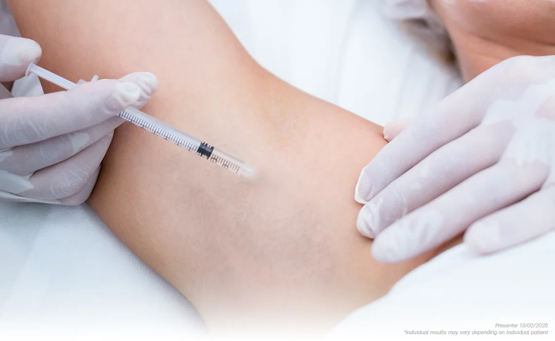 Excessive-Sweating-Treatments-by-botox
