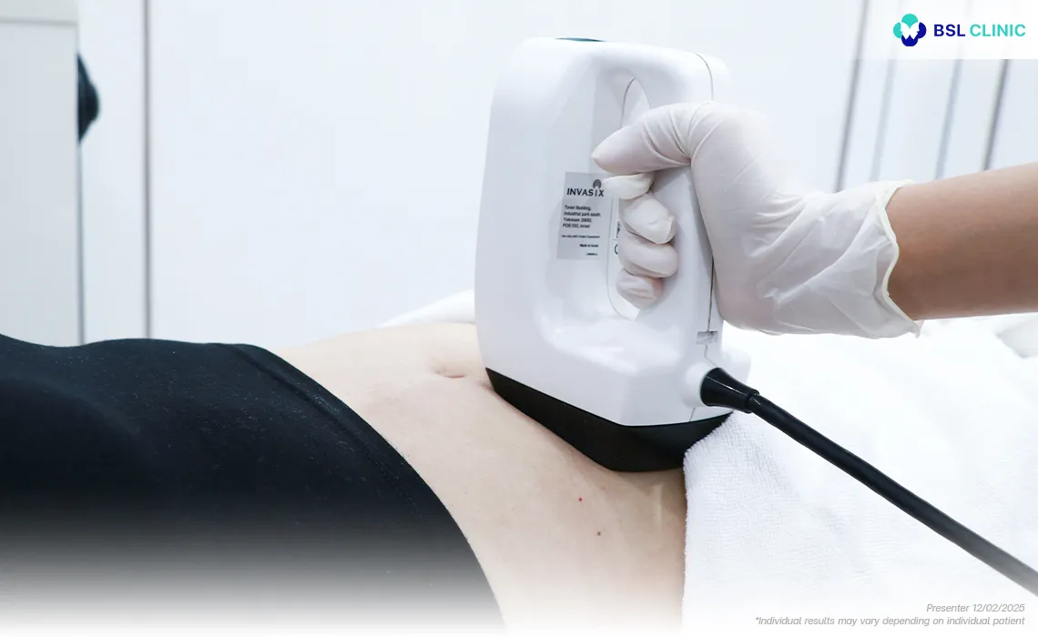 The-Body-Contouring-FX-treatment