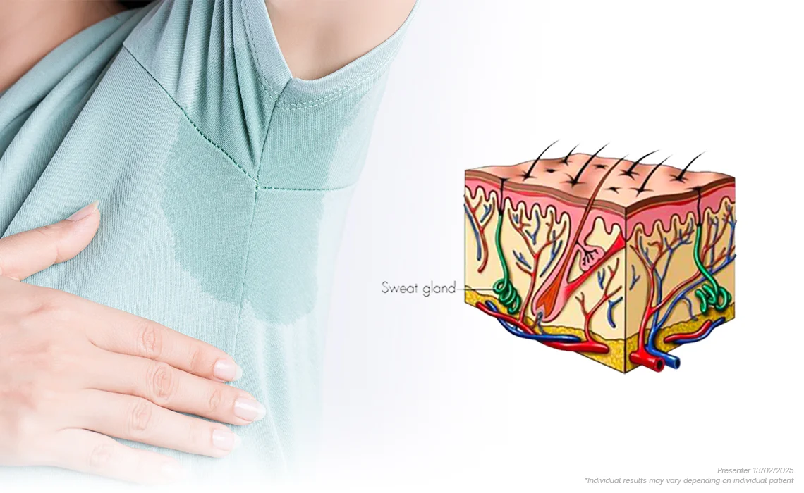 sweat-gland
