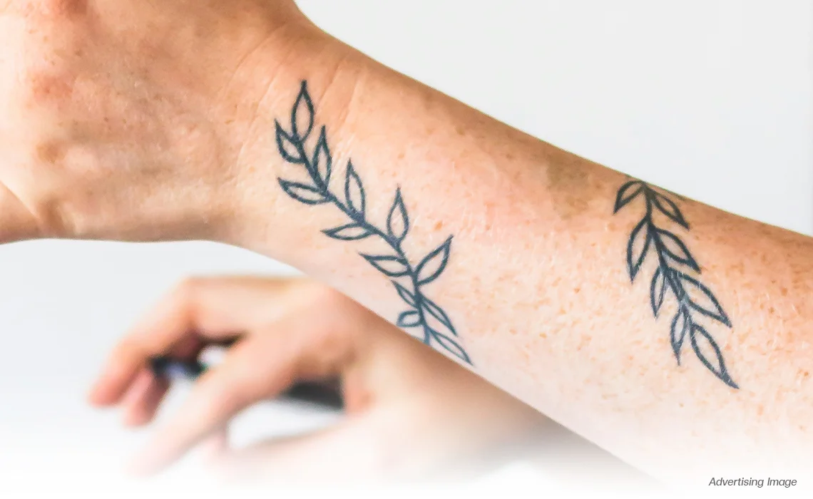 black-grey-Tattoo-Removal