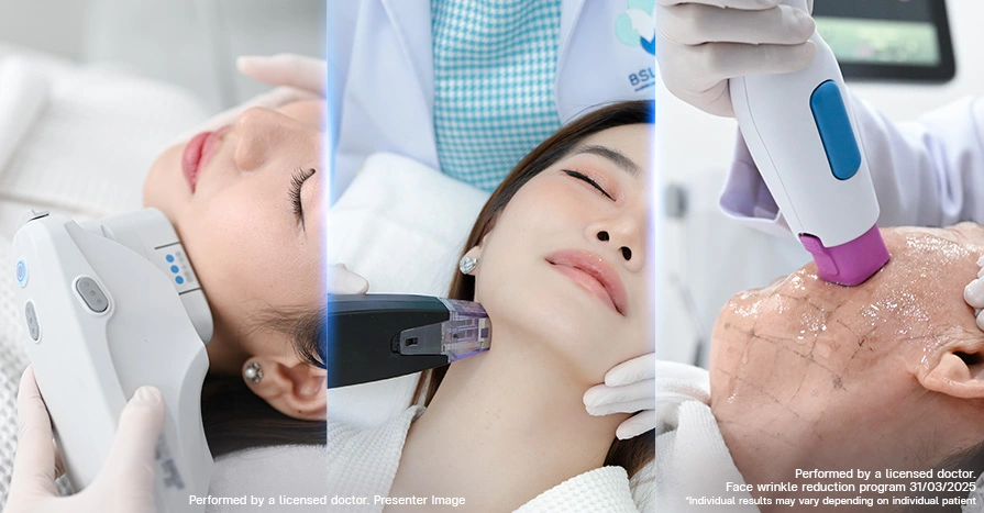 Non-Surgical Lift & Tightening