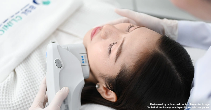 Face Lifting Ultherapy Program