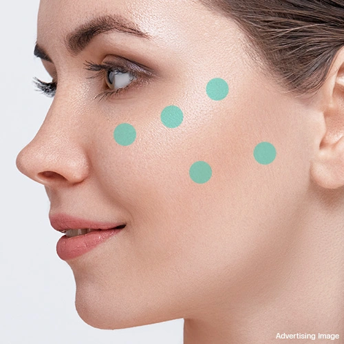 cheek-volume-restoration-with-filler-for-younger-facial-design