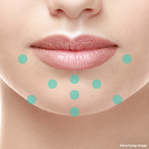 chin-augmentation-filler-for-harmonious-facial-design-and-younger-appearance