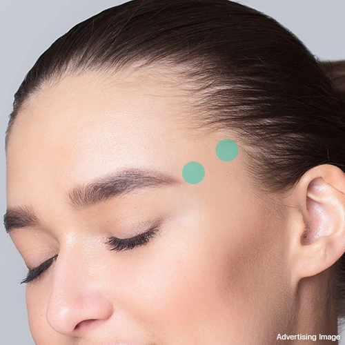 temple-filler-for-balanced-facial-design-and-younger-side-profile