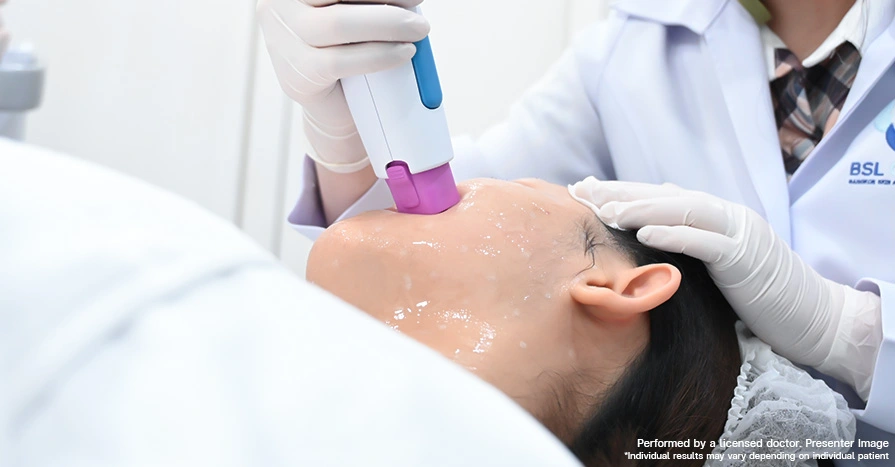 Thermage FLX Program