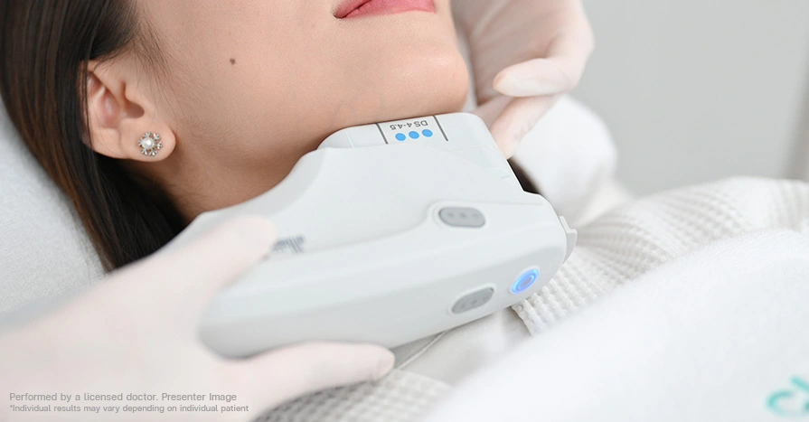 ultherapy-lifting-treatment-for-younger-facial-design-without-surgery