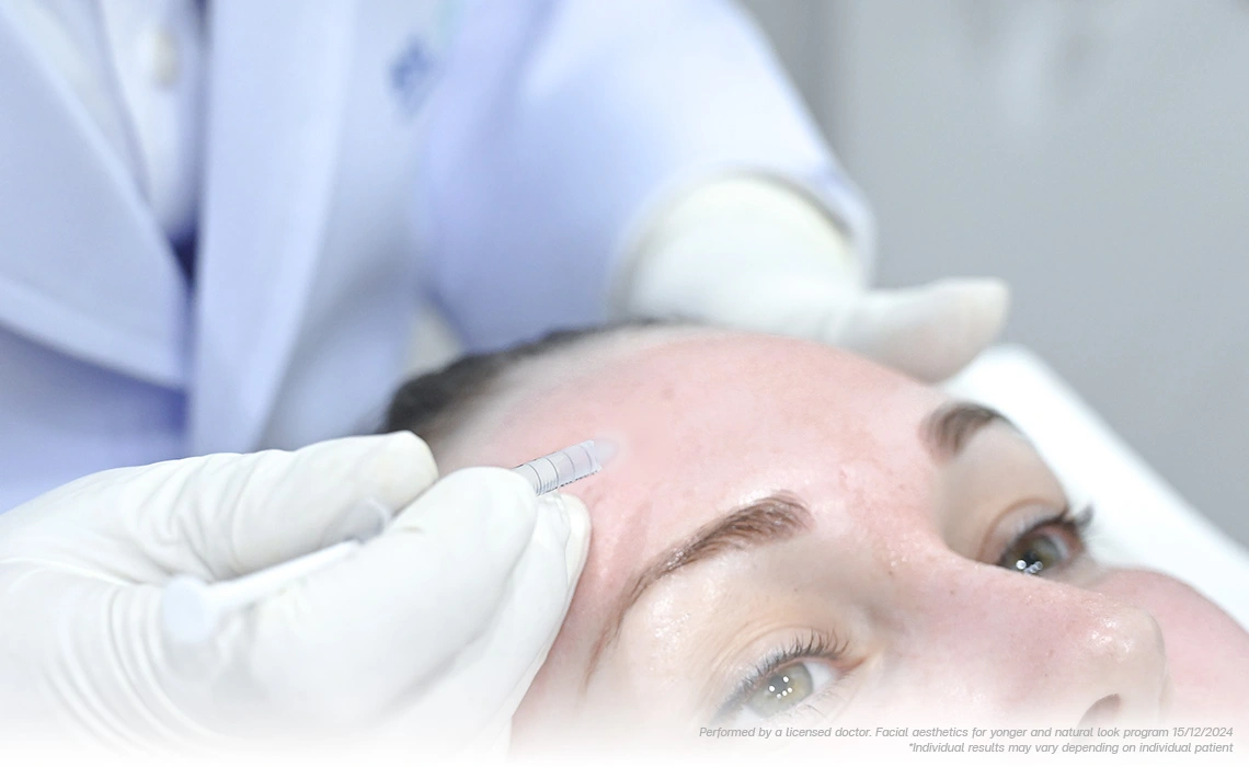 anti-wrinkle face lift injection for preventing early forehead and eye lines in 30s
