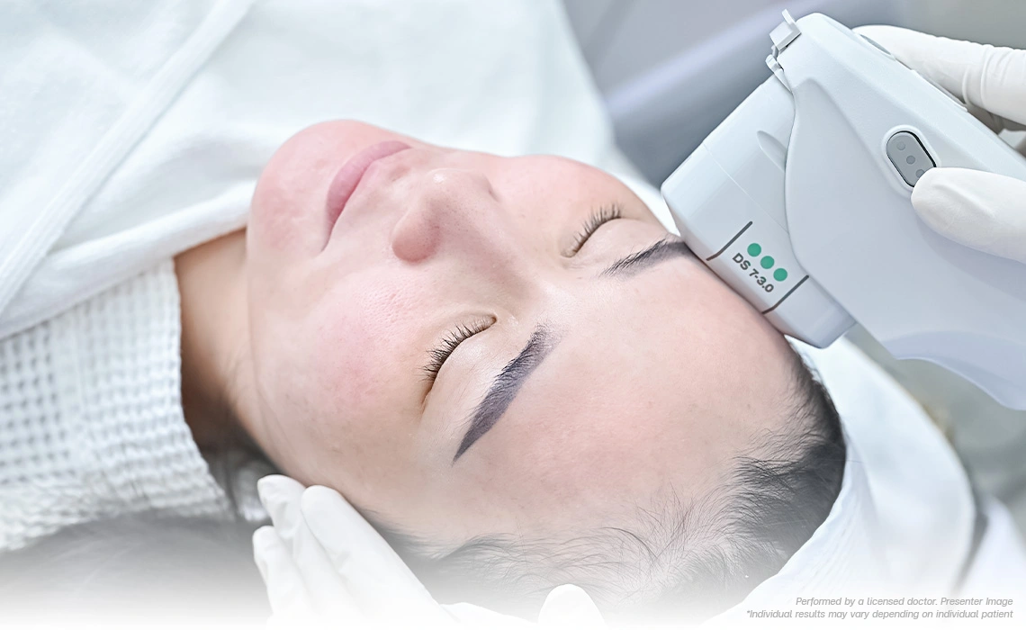 non-surgical-face-lift-ultherapy-program-for-sagging-skin-jawline-lift-in-40s-without-downtime