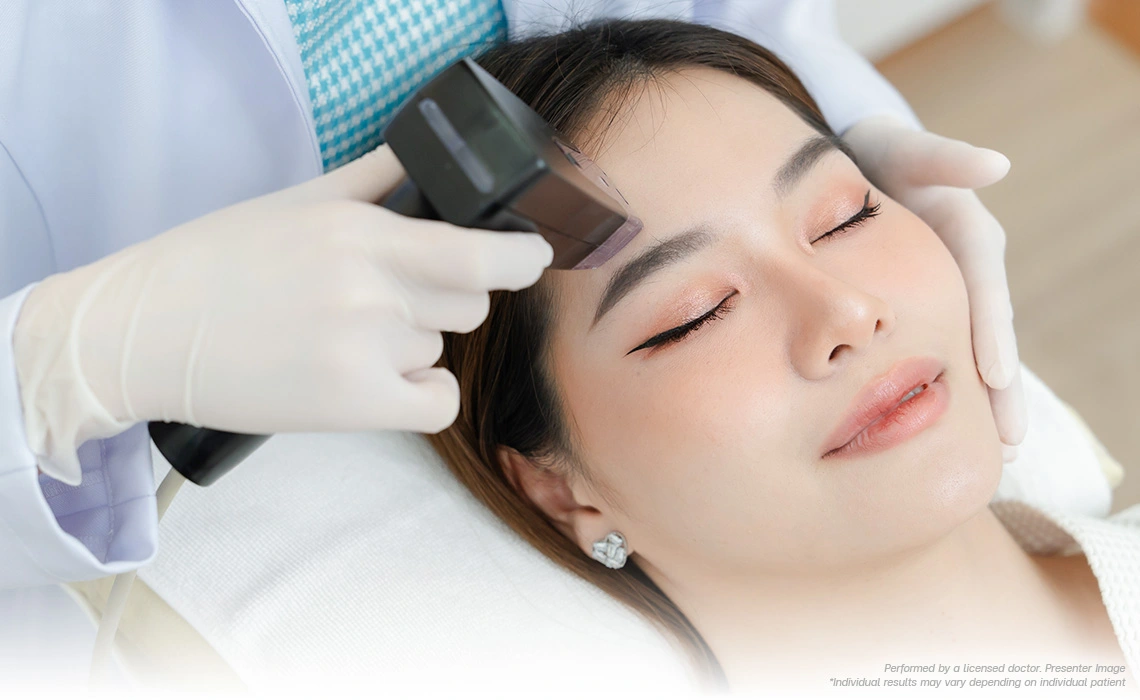 morpheus8-face-lift-skin-refinement-and-pore-tightening-for-20s