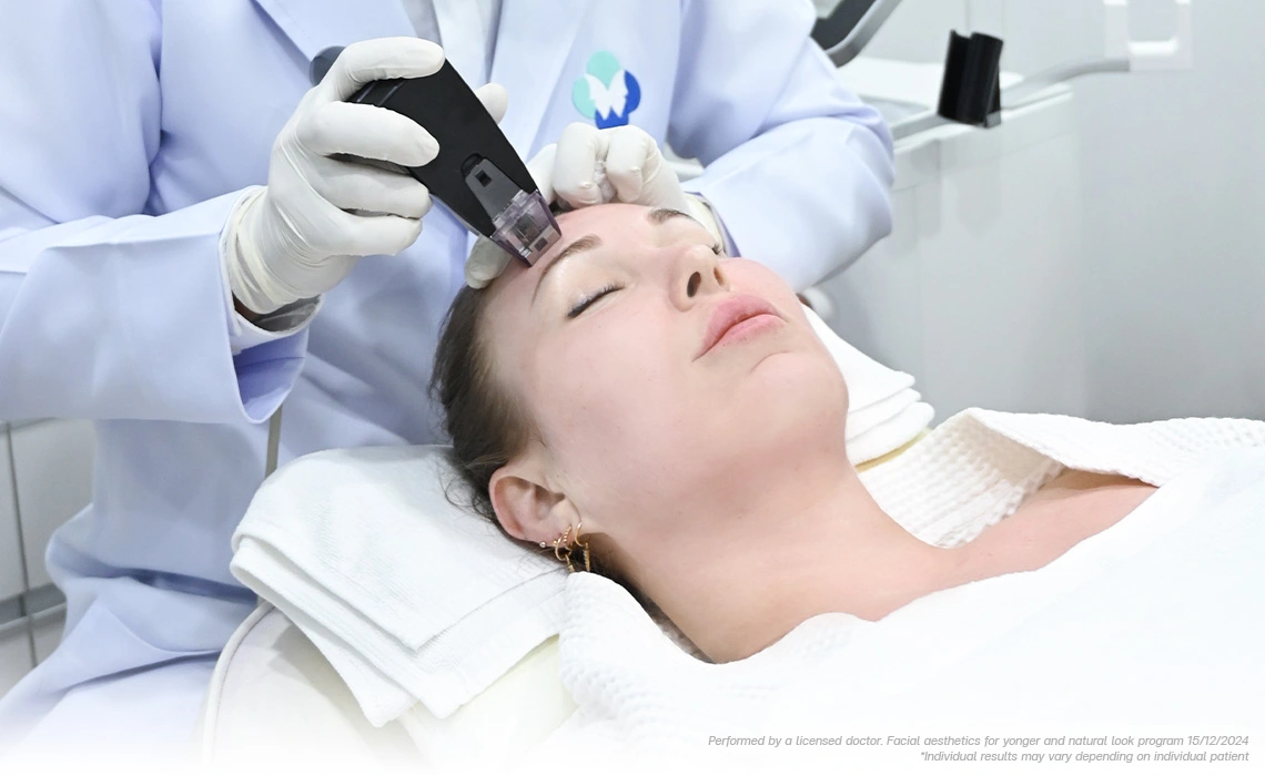 morpheus8 face lift skin refinement and pore tightening for 20s