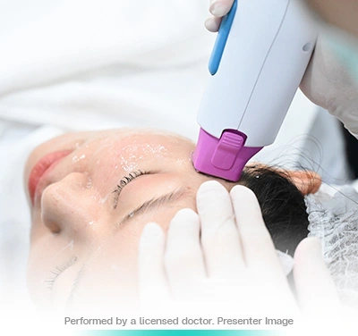 thermage-flx-face-lift-skin-tightening-treatment-non-surgical-firm-and-smooth-program