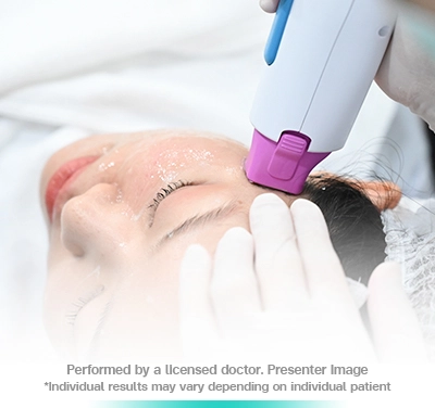 thermage-flx-face-lift-skin-tightening-treatment-non-surgical-firm-and-smooth-program