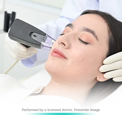 morpheus8-microneedling-rf-face-lift-sculpt-and-refine-skin-rejuvenation-non-invasive-contour