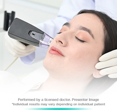 morpheus8-microneedling-rf-face-lift-sculpt-and-refine-skin-rejuvenation-non-invasive-contour