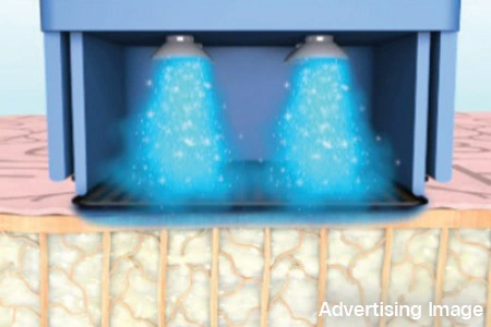 Skin Tightening
