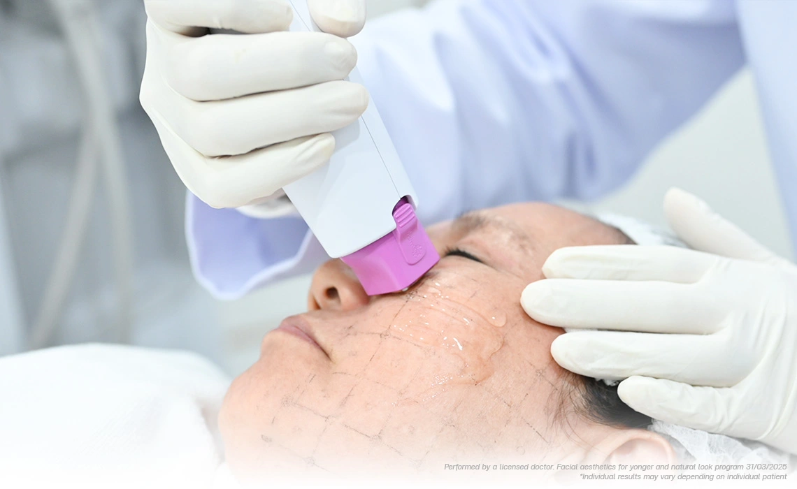 Thermage flx