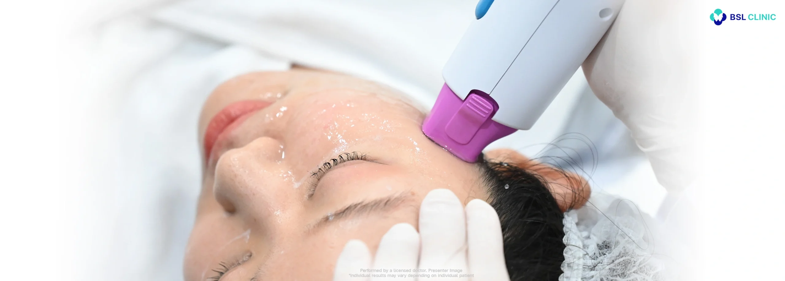 Your Thermage FLX Program Experience with BSL Clinic