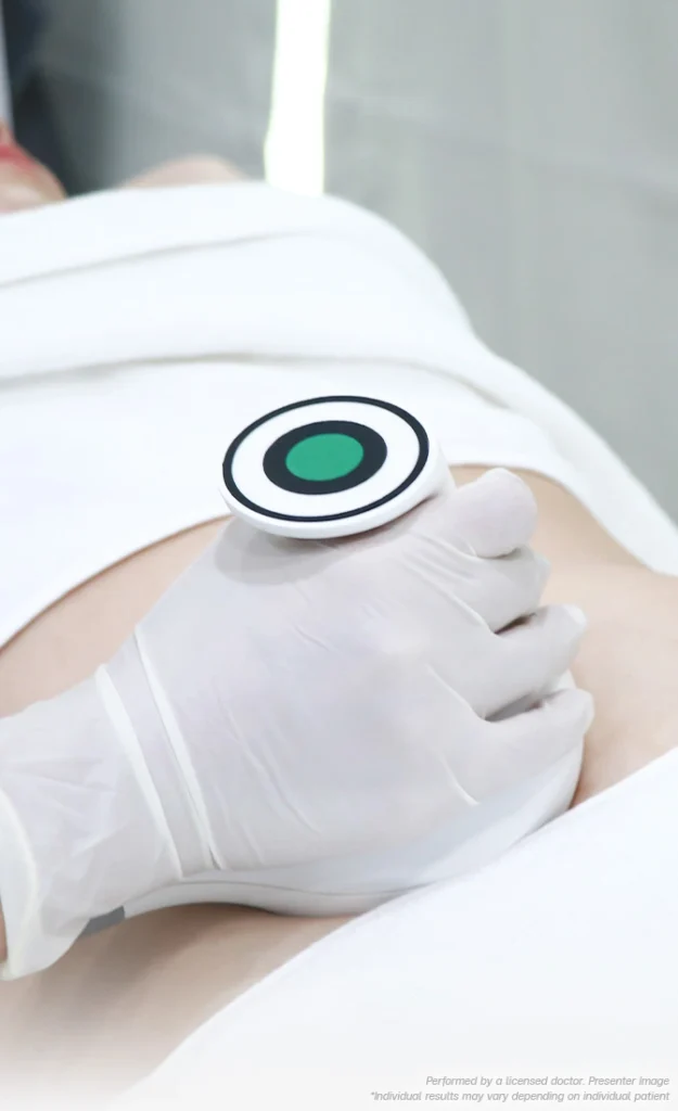 bsl clinic body contouring feizhengrong shoushen rongzhi jinji pifu