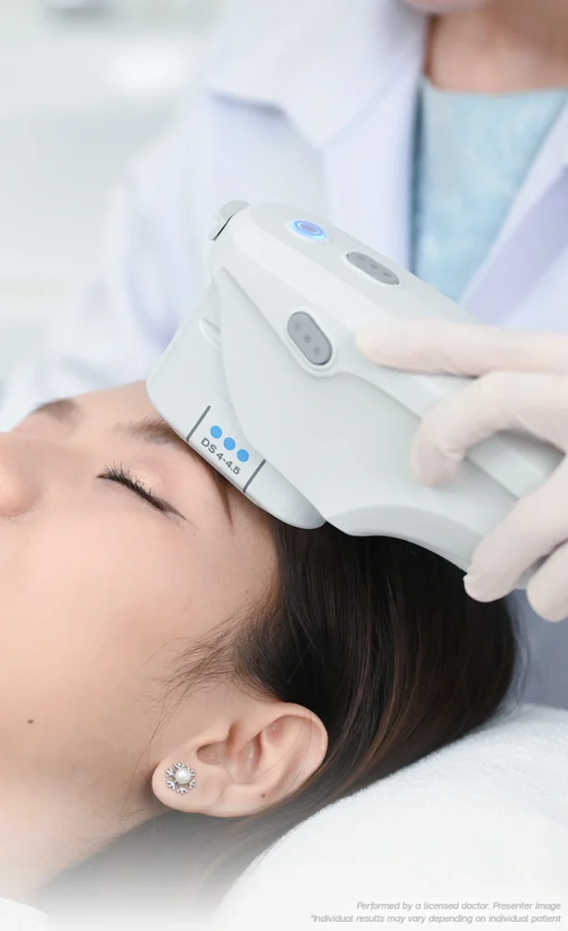 bsl clinic thermage flx chaoshengdao ultherapy mianbu jingshou manggu