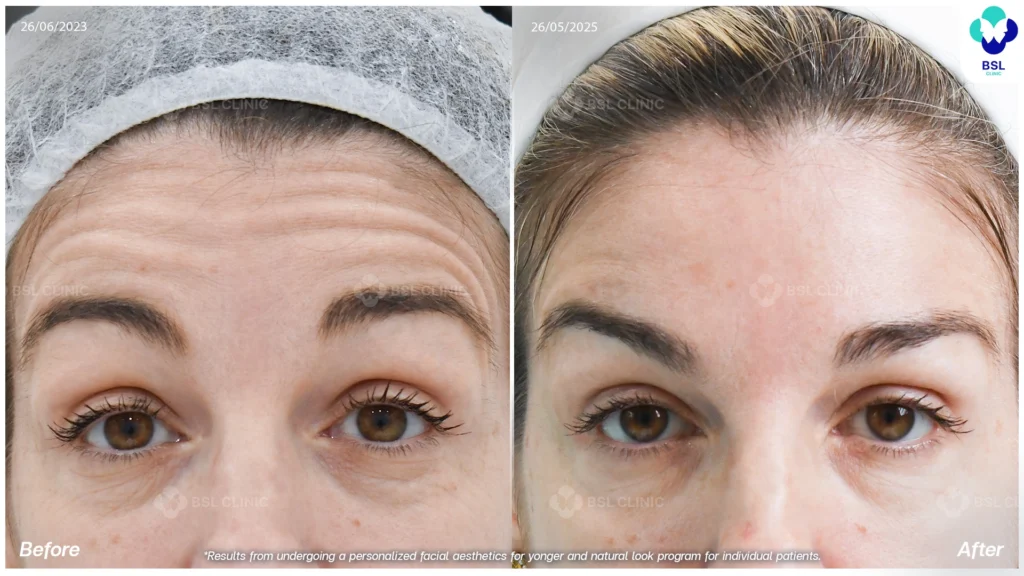 result Facial Design and Anti-Defying Treatments