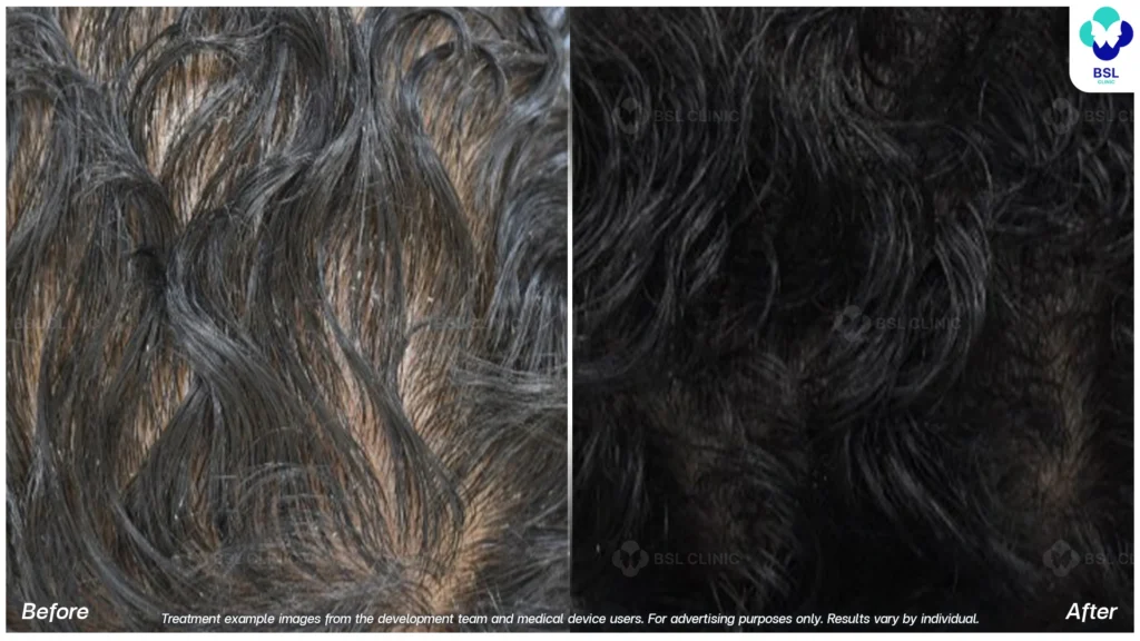 result Hair and Scalp Treatments
