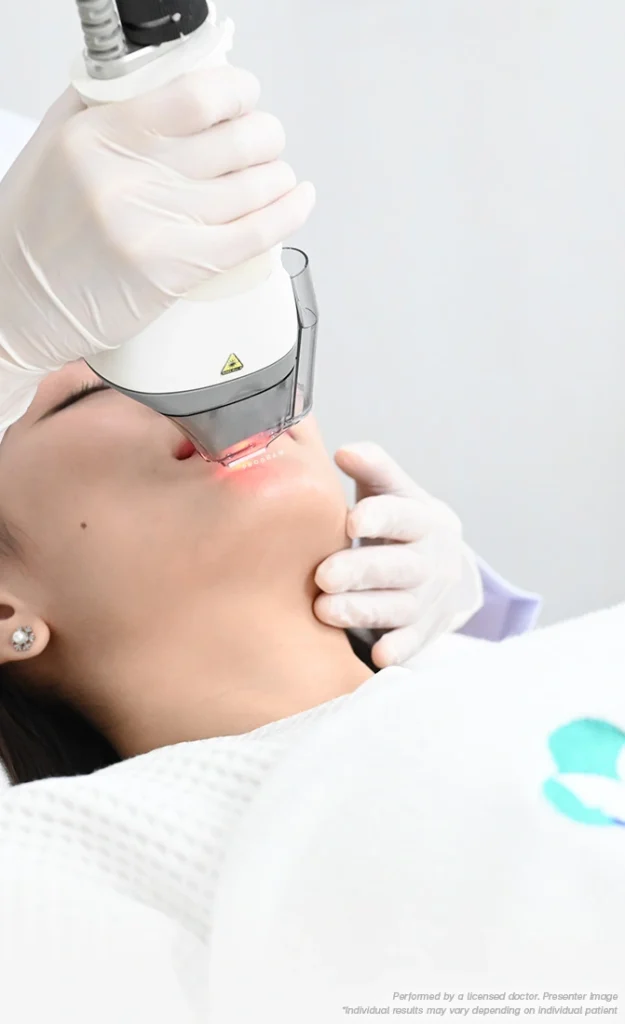 Resurfacing Laser