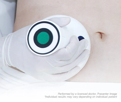 Technologies Body Contouring