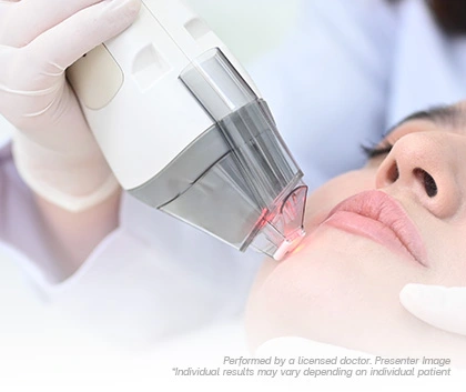 Technologies Skin Laser