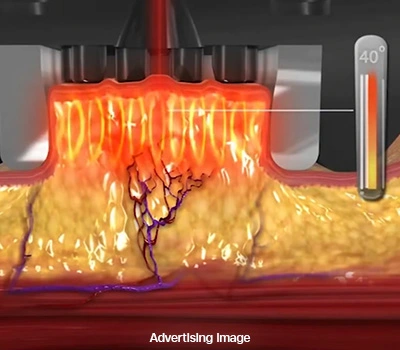 Fat Removal Body Contouring Technologies Program BodyFX