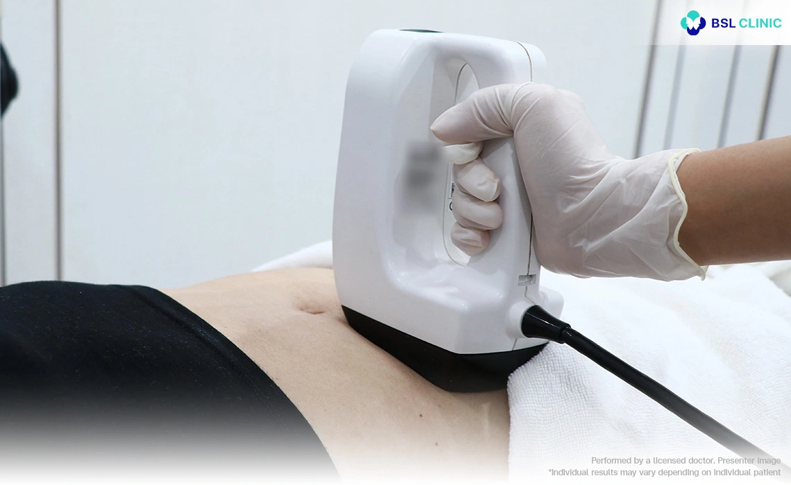 The Body Contouring FX treatment