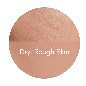 rejuran healer dry rough skin moisture balance polynucleotide rejuran skin treatment